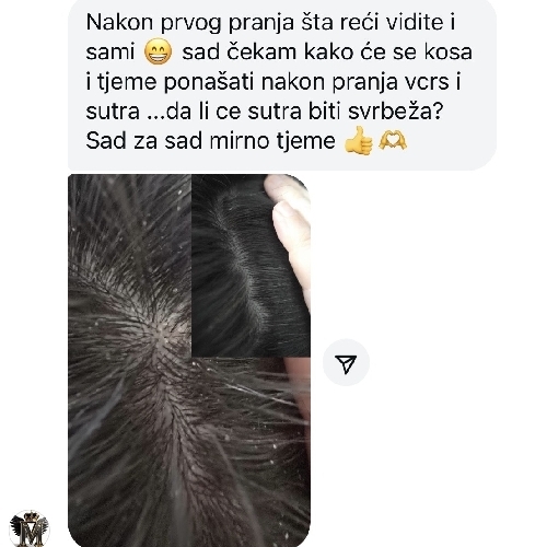 image(20) â kopija