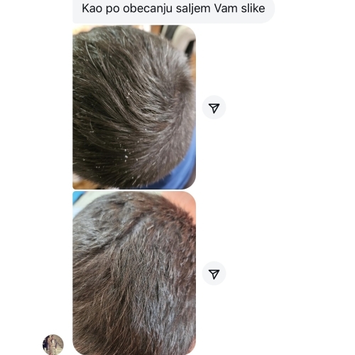 image(30) â kopija